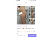 복부,허벅지 지방흡입