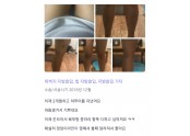 허벅지, 힙라인 지방흡입 경과 후기