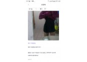 복부지방흡입 8일차 후기